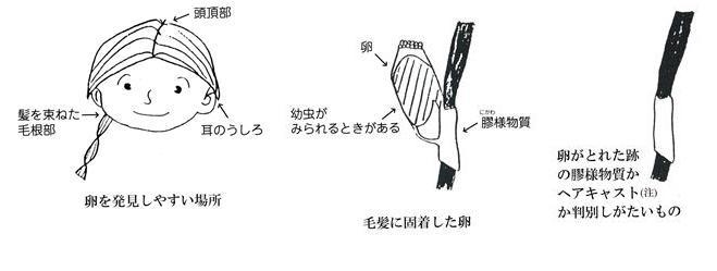 アタマジラミを見つけたら 東大阪市