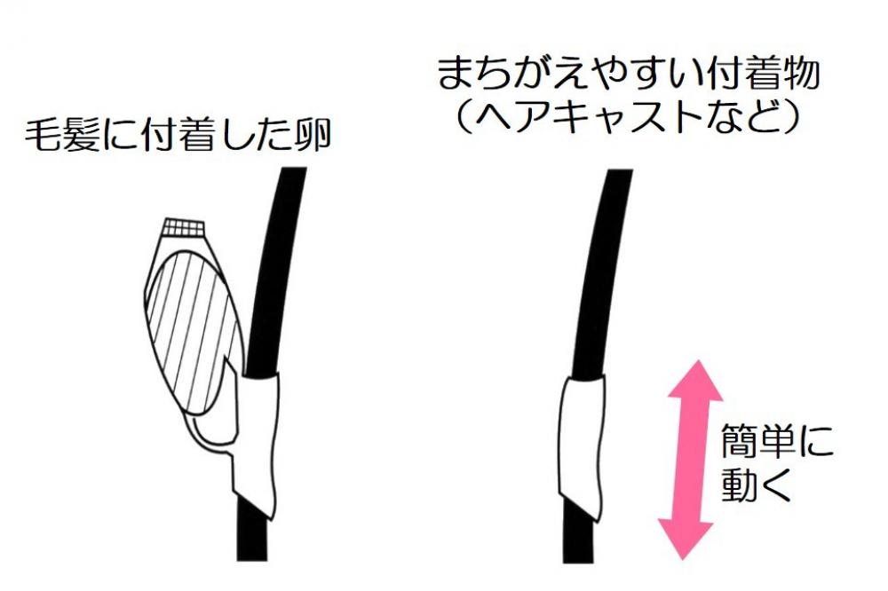 卵とヘヤキャスト